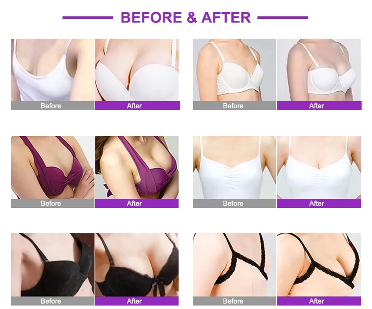 تكبير الأرداف و الأوراك، مضخة تكبير، مدلك، جهاز تجميل، تشكيل الجسم، حجامة، علاج بالشفط 4