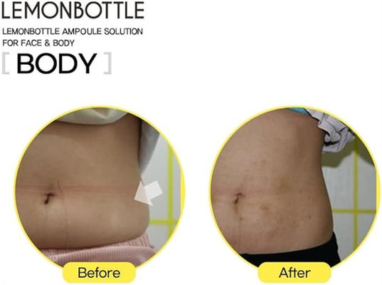 زجاجة ليمون ليبولاب تحليل الدهون فقدان الوزن