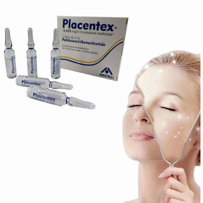 3 مل من مادة Poly Deoxy Ribo Nucleotide الحشوات الجلدية لندوب حب الشباب